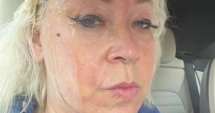 Midwife who was pelted with eggs and flour by mindless guys as she drove to see patients

